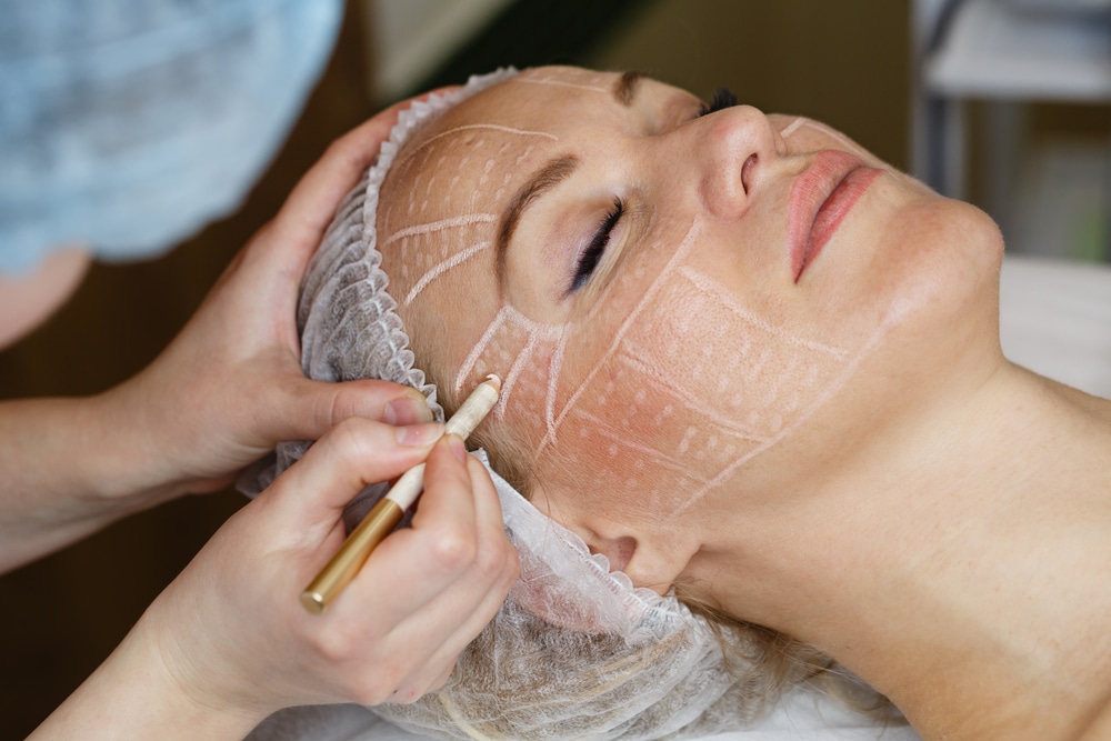 Best Treatment for Facelift