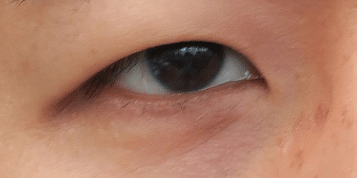 Asian Mono-lidded Eye