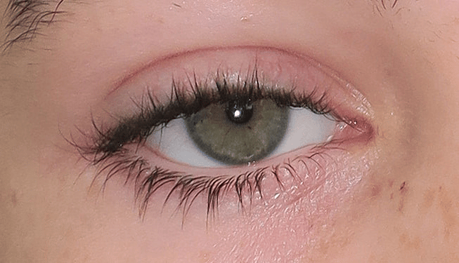A Typical Caucasian Eye configuration (child)