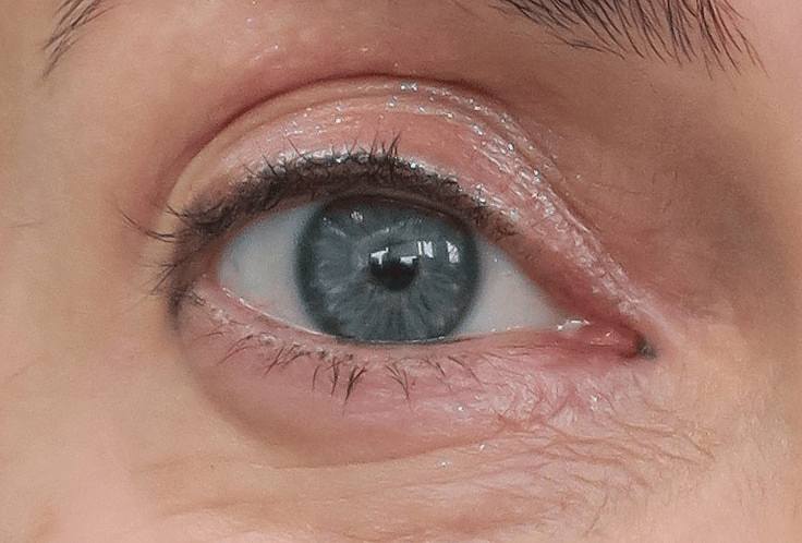 A Typical Caucasian Eye Configuration